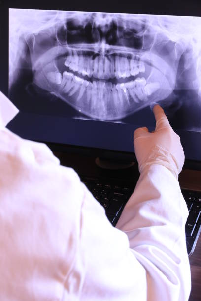 Best Emergency Tooth Extraction in Lawton, IA